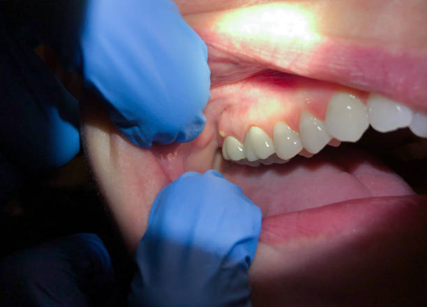 Best Broken or Cracked Tooth Emergency Dentist in Marion Oaks, FL